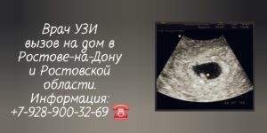 УЗИ на дому Ростов-на-Дону и РО