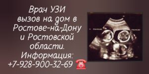 УЗИ на дому Ростов-на-Дону и РО