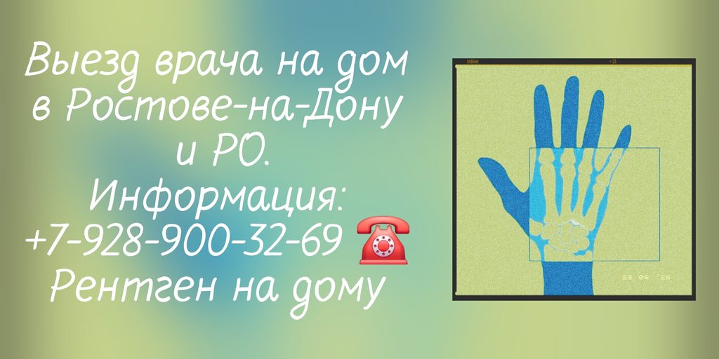 Ростов-на-Дону - Вызов врача Рентген на дому