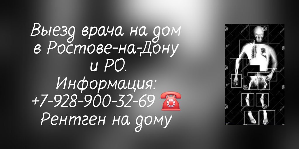 Ростов-на-Дону - Вызов врача Рентген на дому