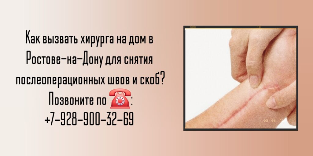 Снять послеоперационные скобы или швы на дому Ростов-на-Дону