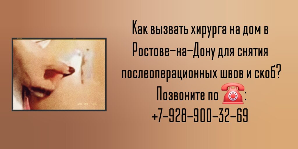 Снять послеоперационные скобы или швы на дому Ростов-на-Дону